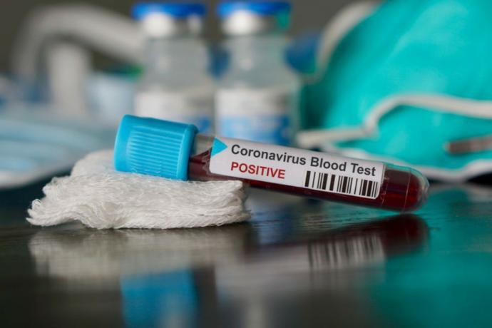 Coronavirus, a valid threat or simple fear mongering?