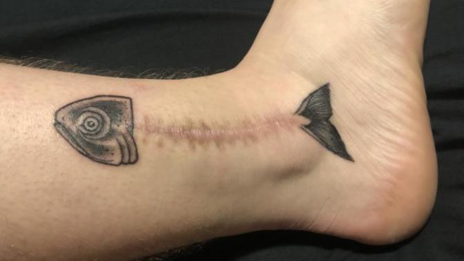 Can or should I get tattoos on my scars?