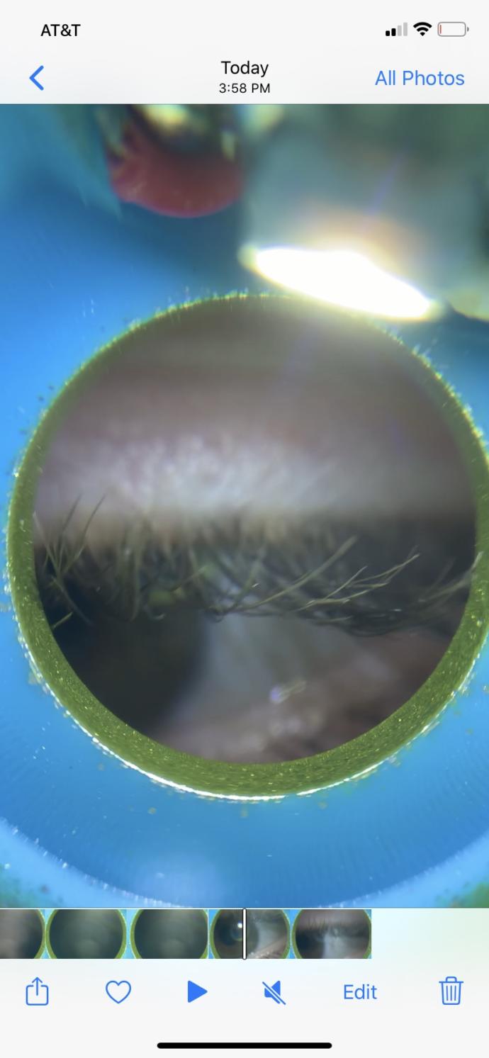 Do I have distichiasis?