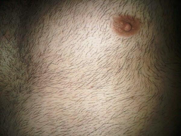 When there is too much of chest and stomach hair?