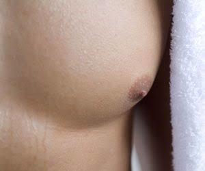 When there is too much of chest and stomach hair?
