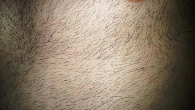 When there is too much of chest and stomach hair?