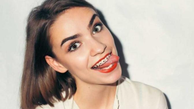 Would you still be interested in a person even if she/he had braces?