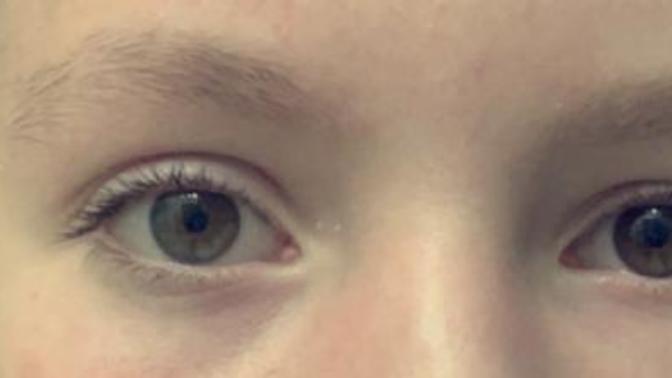 Are my eyes different colors?