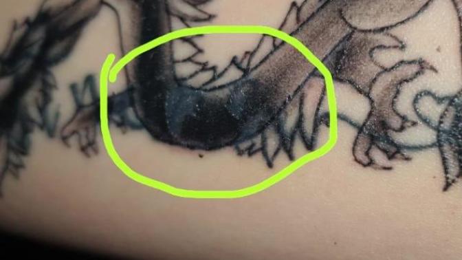 Is this normal healing for a tattoo?