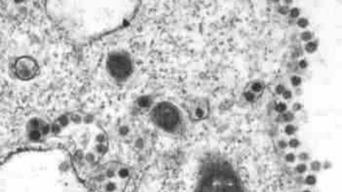 Common sense approach to the Corona virus?