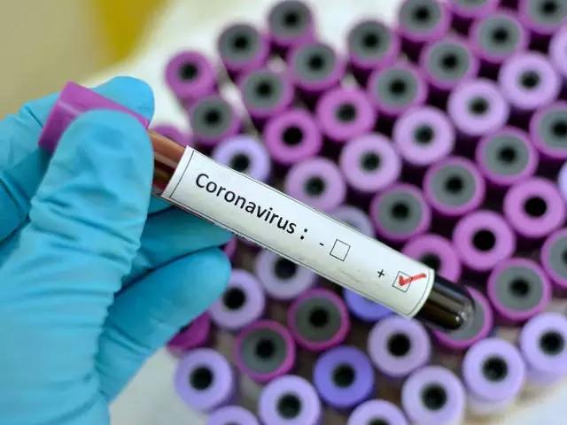 Are you wearing mask to prevent Corona Virus?