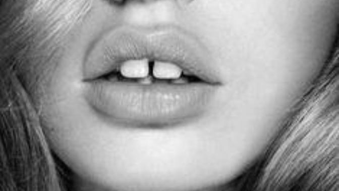 What's your opinion on gapped teeth?