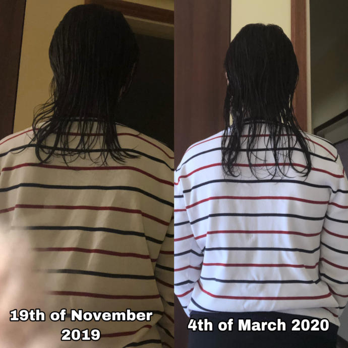 Is this much hair growth fast, normal or slow?
