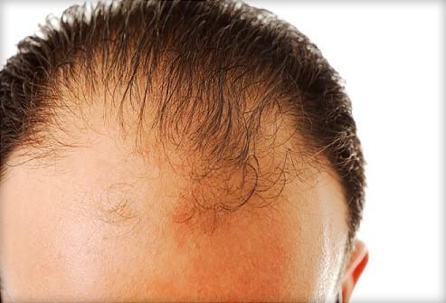 How important is his hair?