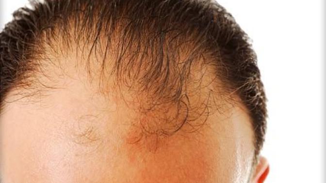 How important is his hair?
