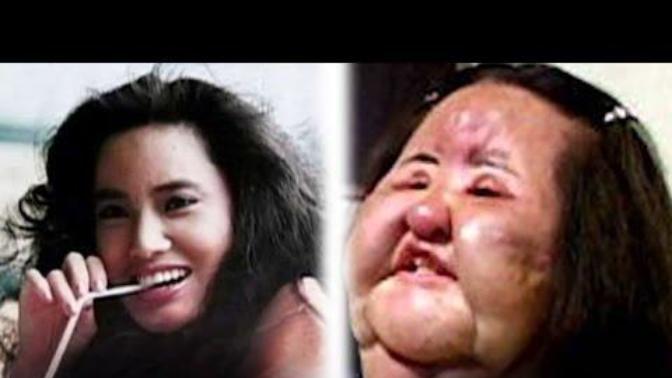 Do you like/support celebrities who get plastic surgery?