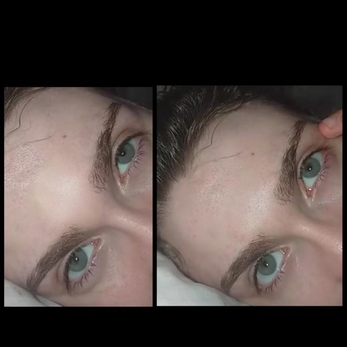 With lenses