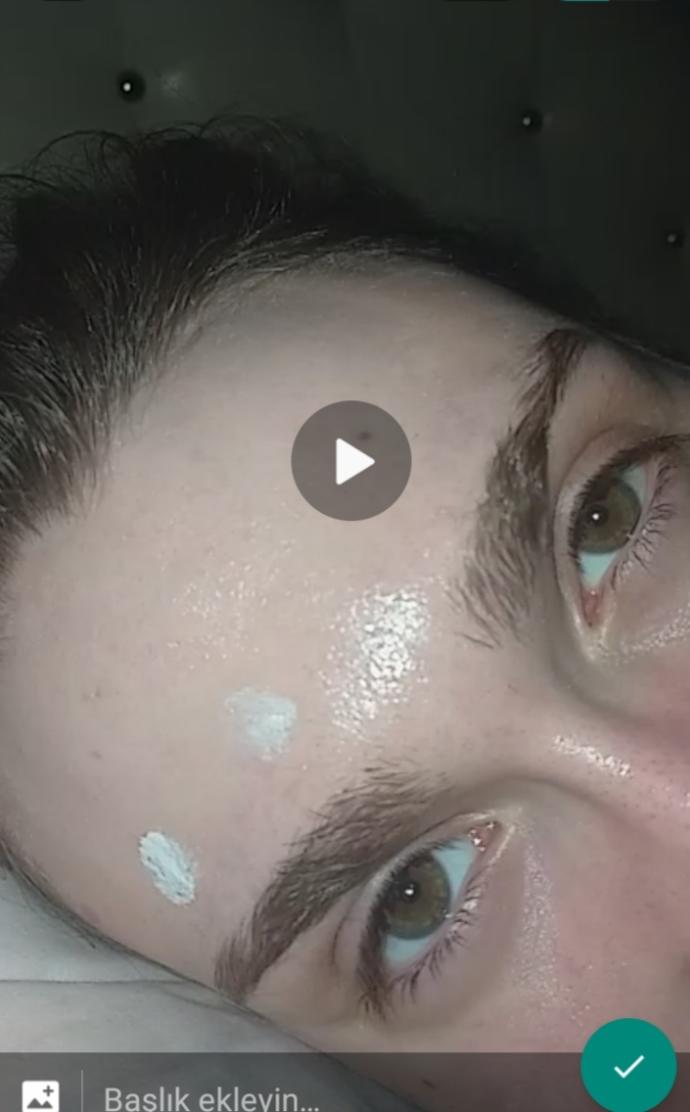Real eye color
