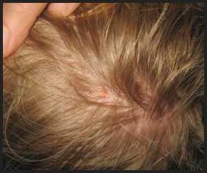 Should I EMBRACE my GENETICALLY bad hair?
