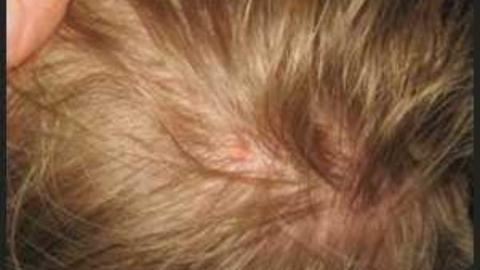 Should I EMBRACE my GENETICALLY bad hair?