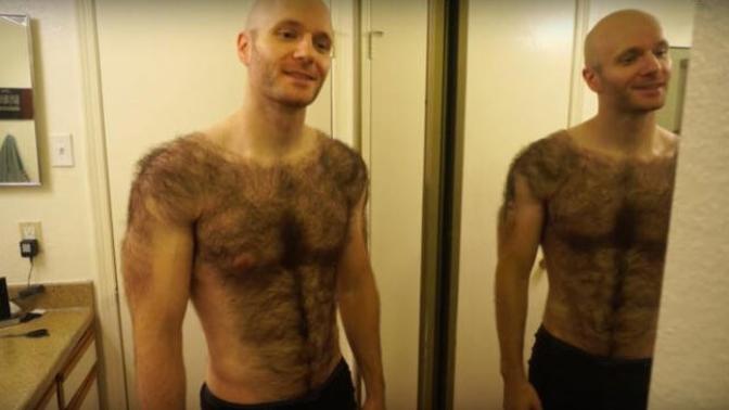 Is being too hairy a valid reason to give up on dating relationships and marriage?