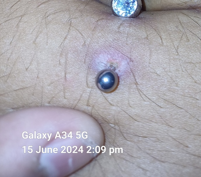 Is it healing or infected, belly button piercing?