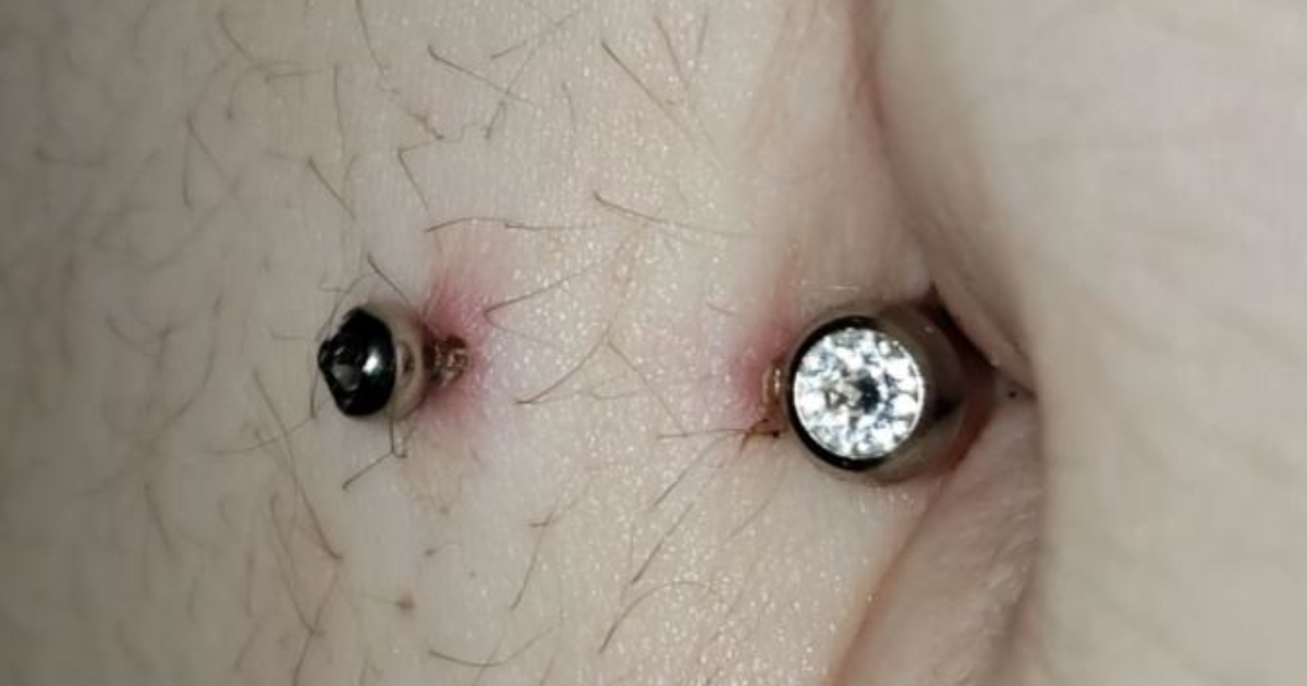 Is it healing or infected, belly button piercing? - GirlsAskGuys