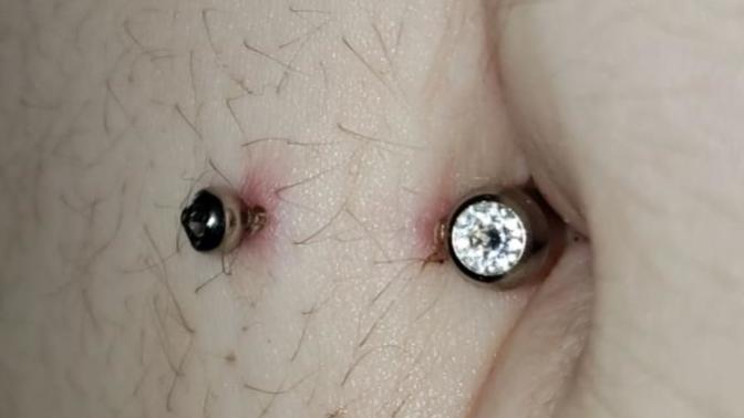 Is it healing or infected, belly button piercing?
