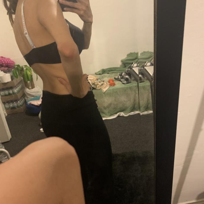 How can I gain weight & swallow food without choking?