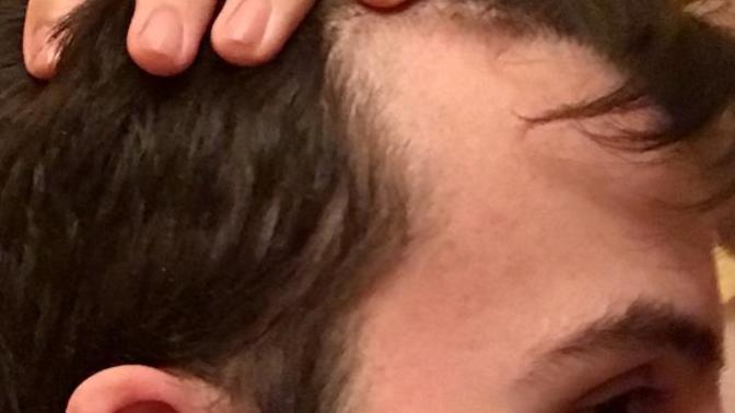 Should I shave my head or just comb down my hair?