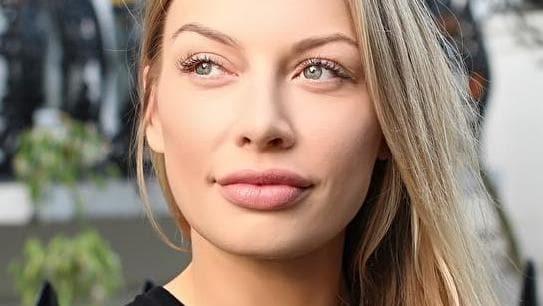 Why do people get lip fillers, its so ugly?