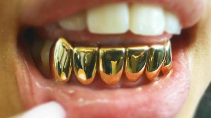 Ladies, do you find men who wear gold teeth (pull out ones) attractive?