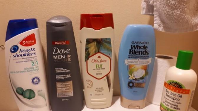 Hairloss/itchy head, what should I do?
