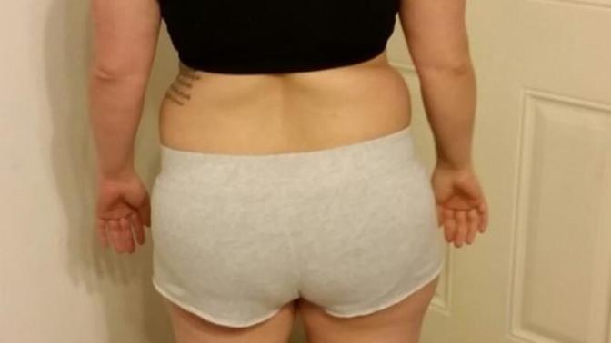 Am I obese or just overweight?