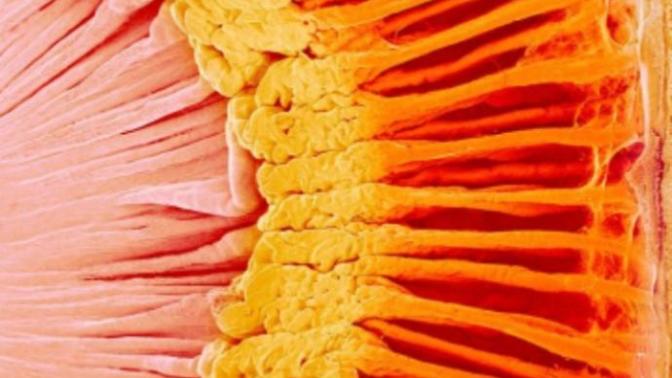 Guess what is this image?