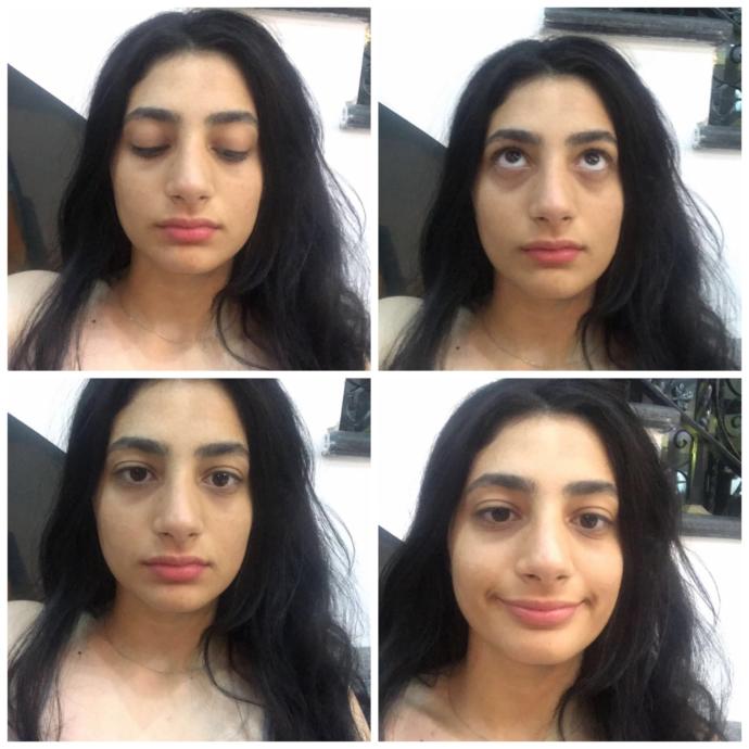 Can I ever get rid of my dark circles?