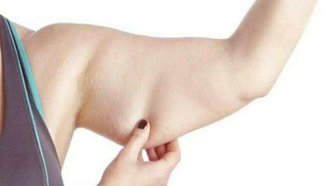 Are flabby arms a turn off for you?