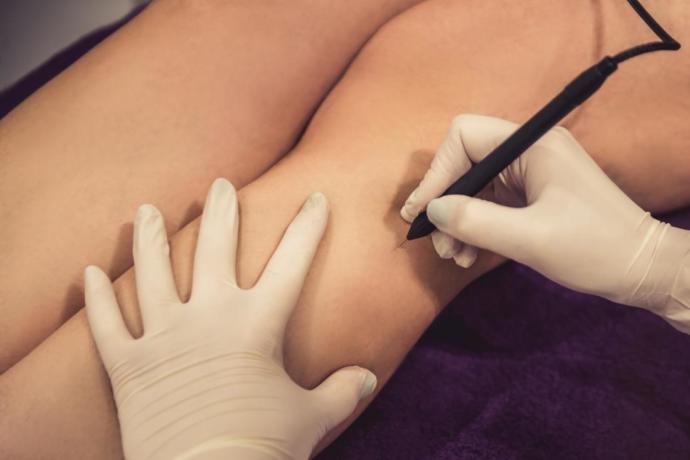 Do you Shave, Sugar, Wax, Epilator, Electrolysis, Laser or AU NATUREL? Do you do it yourself or have a professional do it for you?