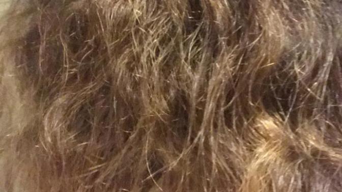 How can I stop pulling my hair?