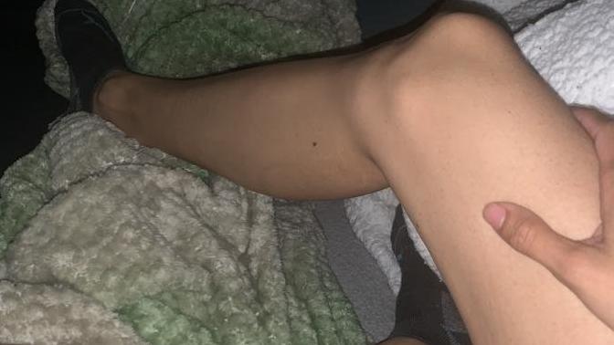 How can I gain weight on legs & get muscle at 80lbs?