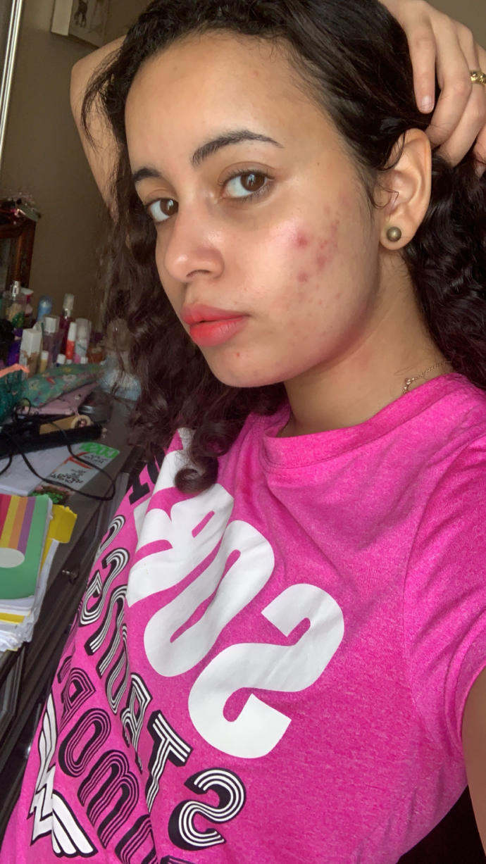 Please help me my skin is very very bad?