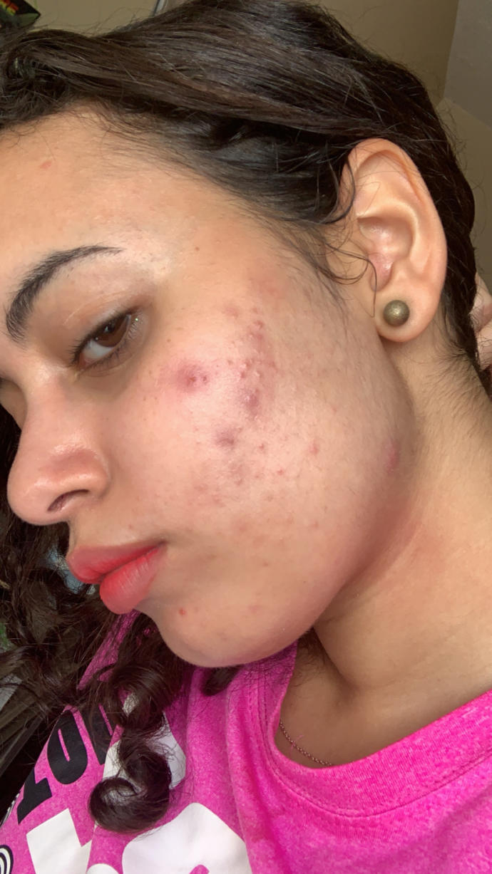 Please help me my skin is very very bad?