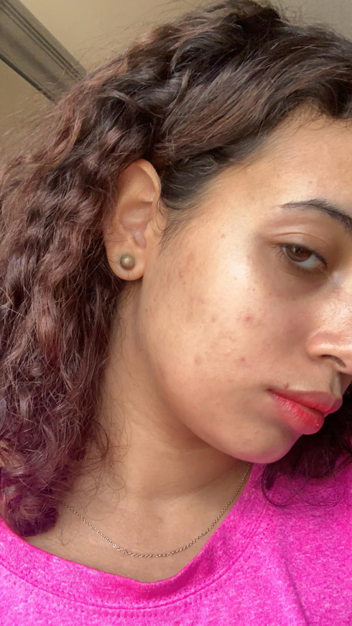 Please help me my skin is very very bad?