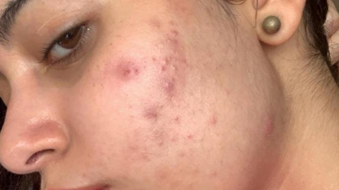 Please help me my skin is very very bad?