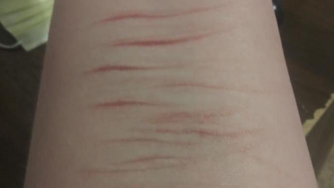 Girls, Would girls date a guy with self harm scars on his wrist and arm and some on shoulders?