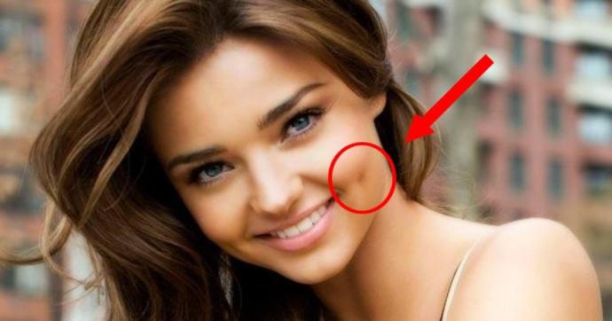 Do You Think Dimples Are Unattractive?