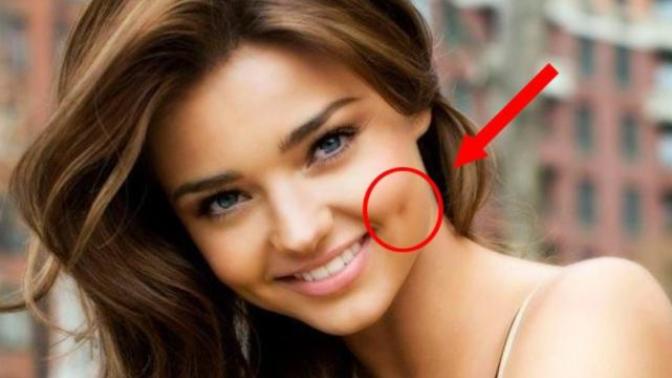 Do You Think Dimples Are Unattractive?