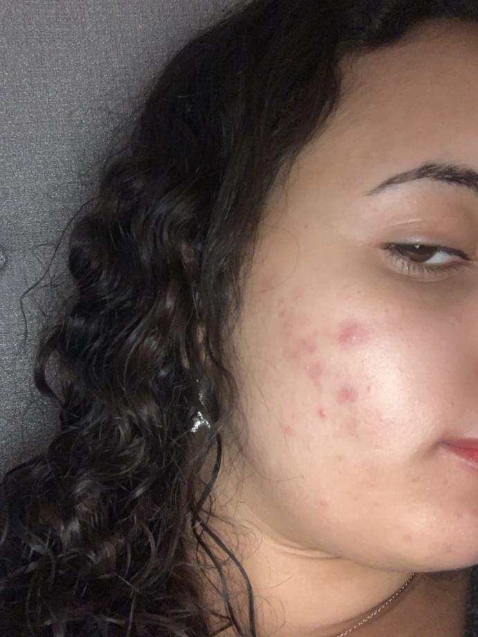 Which facial feature are you most insecure about?