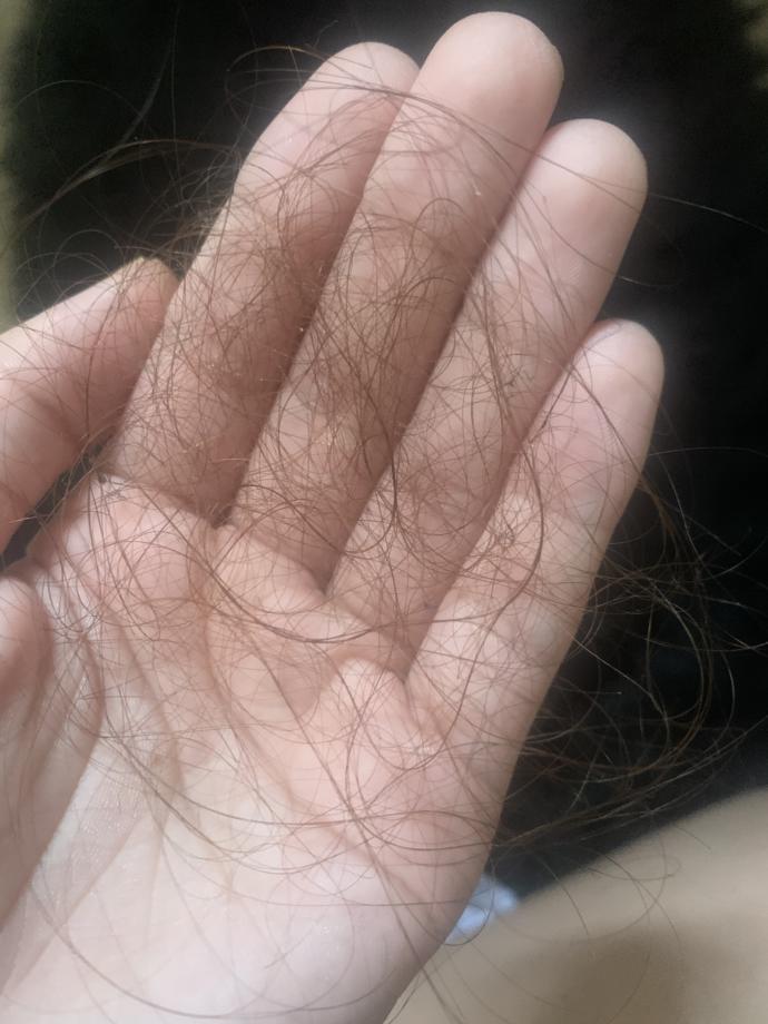 Girls, is this a normal amount of hair to come out after the shower (pic) ?
