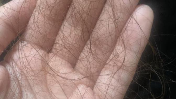 Girls, is this a normal amount of hair to come out after the shower (pic) ?