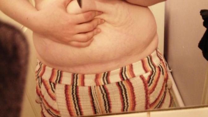 2 in 1, How do I look? and What's the best way to try and tighten skin after a pregnancy?
