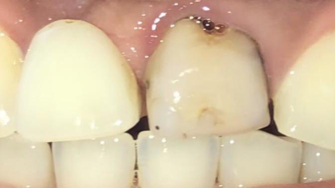 Is their a way to fix my smile at home?