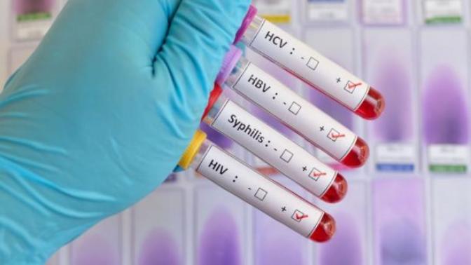 Would you still date someone with herpes or any STD?