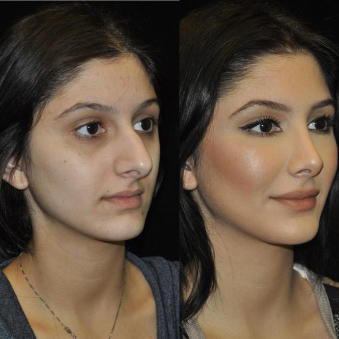 Do you think that plastic surgery is helping peoples confidence?